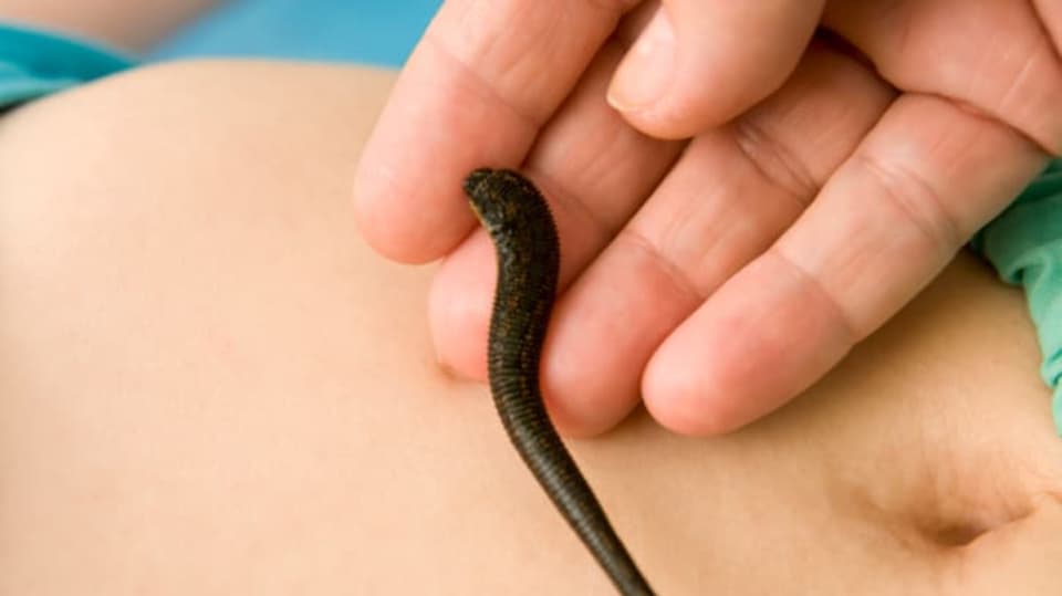 FOTO: Thinkstock